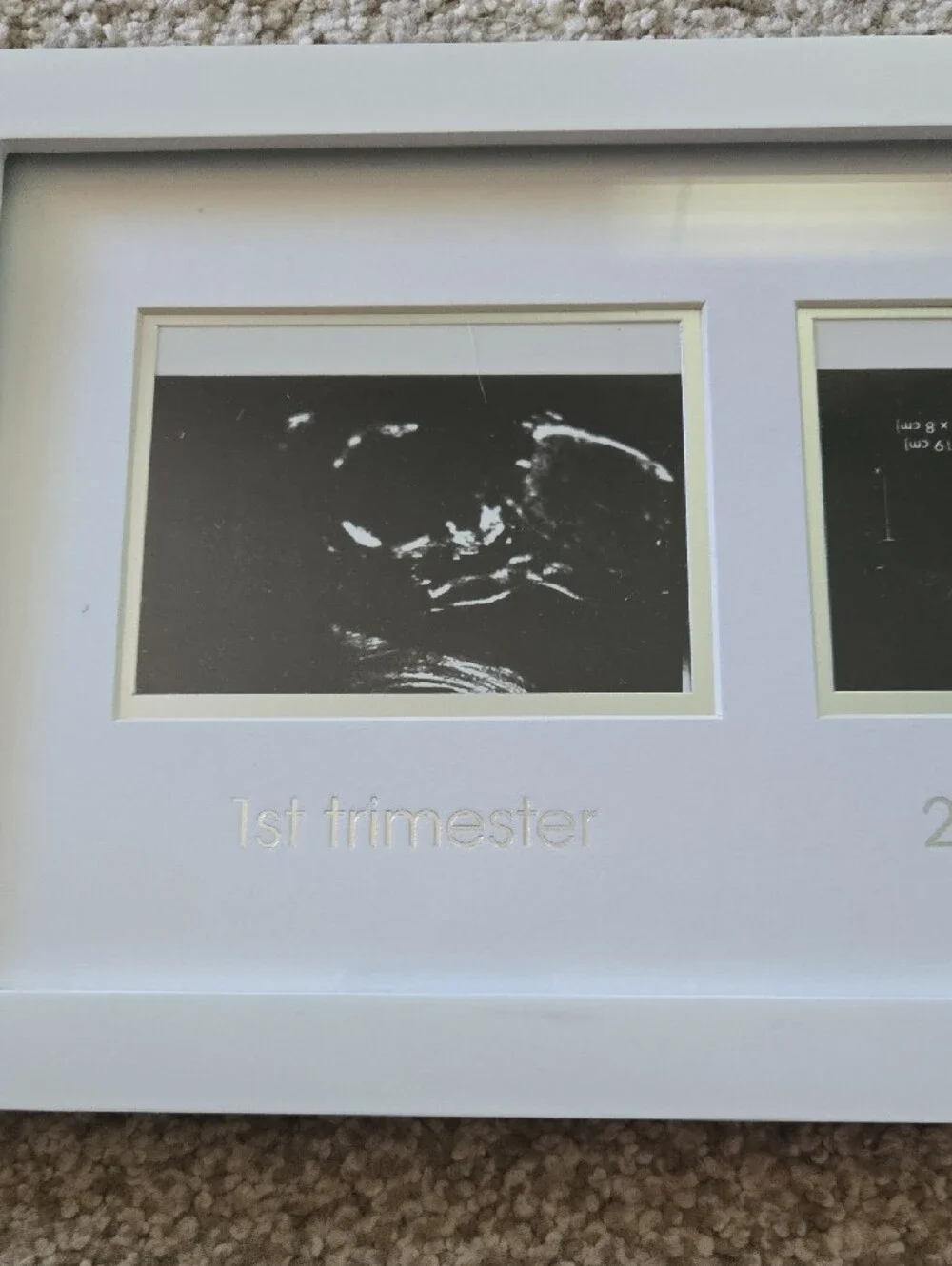 Ultrasound Photo Collage